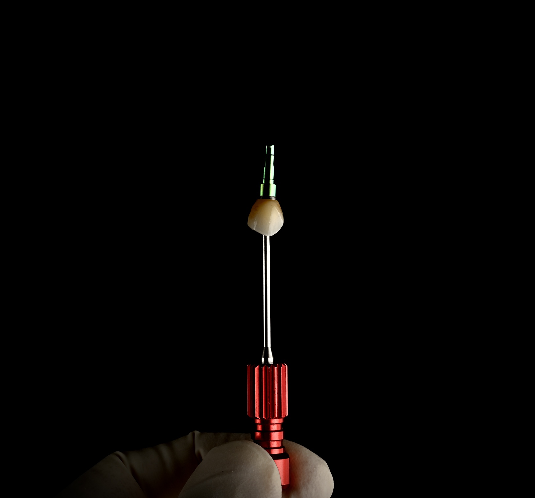 Zahnlux: Hochpräzise Implantat-Krone aus Zirkon mit individueller Farbanpassung.